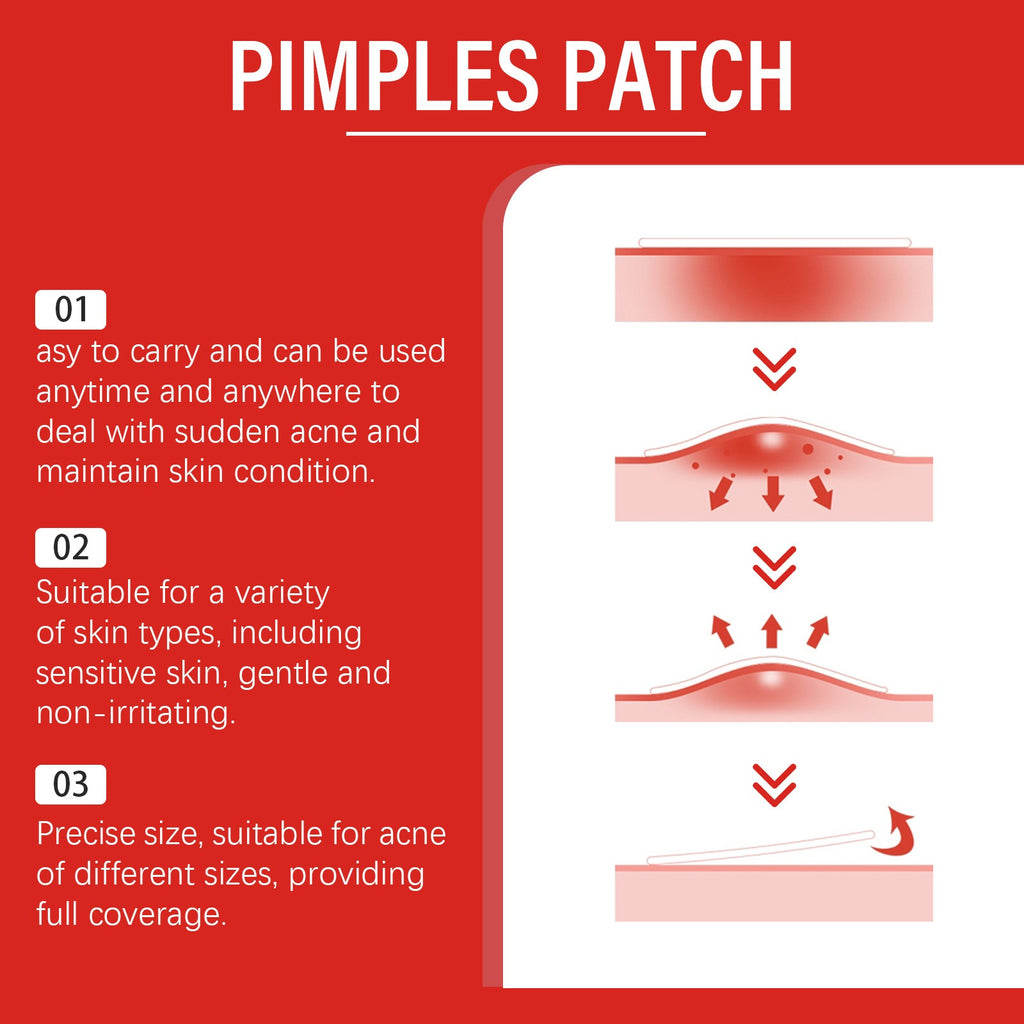240pcs Heart & Star Hydrocolloid Acne Patches